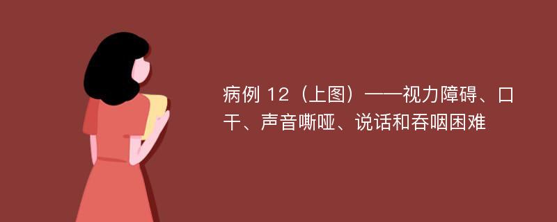 病例 12（上图）——视力障碍、口干、声音嘶哑、说话和吞咽困难